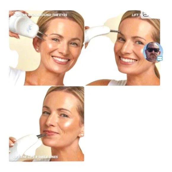 NuFace Effective Lip & Eye Attachment for Trinity+ Microcurrent Device *NEW - Picture 3 of 4